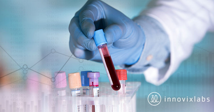 Is there a Vitamin K2 Blood Test? – InnovixLabs